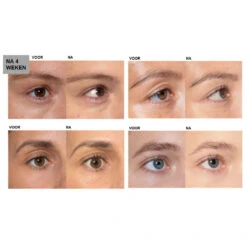 L'Oreal Lu0027Oréal Clinically Proven Wimperserum 9 L'Oreal Lu0027Oréal Clinically Proven Wimperserum -Huid Beauty Winkel 994623 4