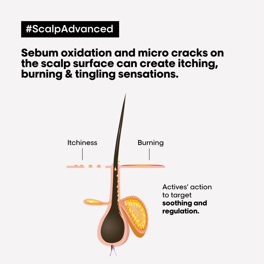 Serie Expert Scalp AdvancedScalp Advanced Anti-Discomfort Dermo-regulator Shampoo 6 Serie Expert Scalp AdvancedScalp Advanced Anti-Discomfort Dermo-regulator Shampoo - Afbeelding 4